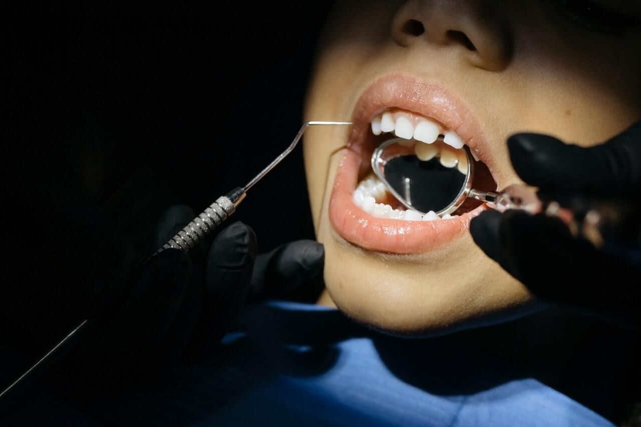 Brak zęba – czym uzupełnić?